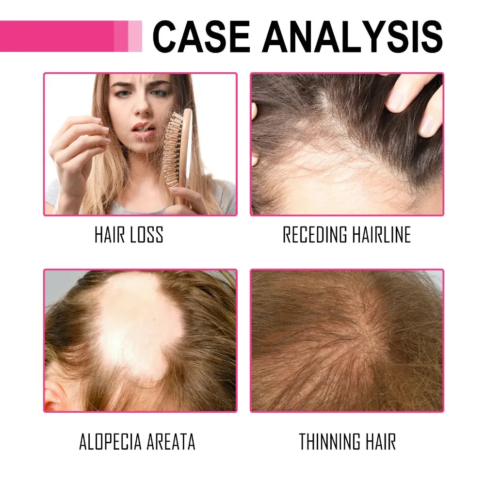 Marokkanisches ätherisches Haaröl zur Befeuchtung und Reparatur von trockenem und krausem Haar